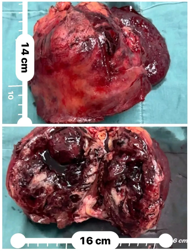 1728353061619795.png 1728353038785.png